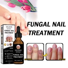 EELHOE Nail Repair Solution Thickening And Shining Nail Removal Dead Skin Repairing And Moisturizing Nail Nutritional Care Liquid